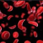 Drépanocytose